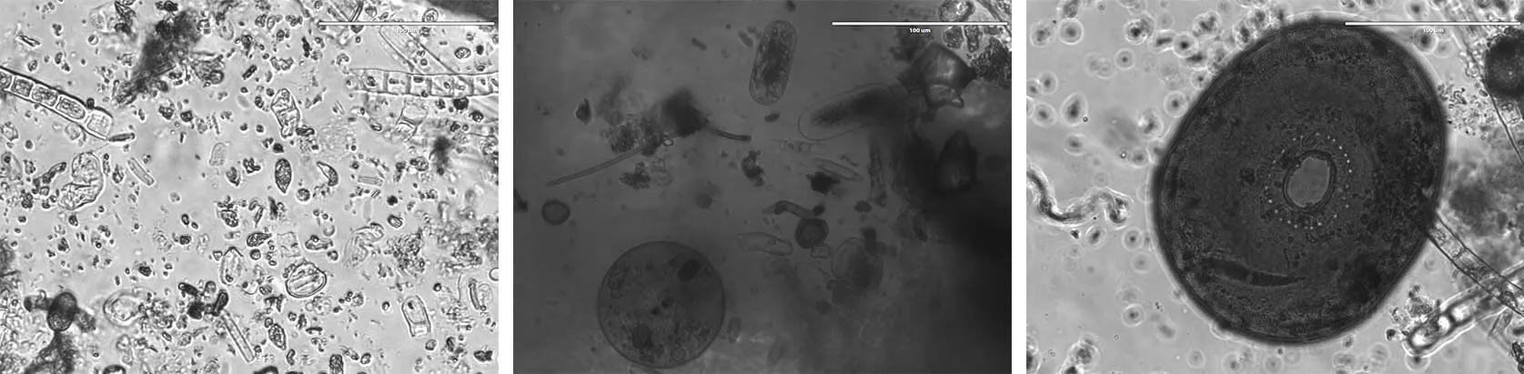 Microscopic Life in Water Samples: bacteria, plant cells, protozoa and microscopic animals mixing, procreating and thriving off of each other&rsquo;s life and death, Slåttmossen Nature Reserve, 2021.